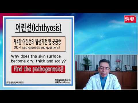 Video: Ichthyosis Vulgaris Og Kost: Er Der En Forbindelse?