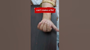 How to make a fist | Fingers stiffness #physicaltherapy #shortsfeed #ytshorts #viralvideo #tips