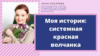 Моя история: Анна Косарева о борьбе с волчанкой, принятии и полноценной жизни