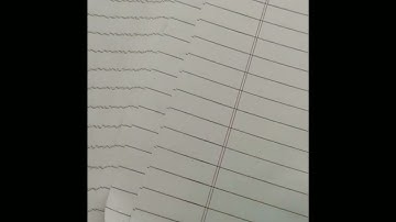 Square of integer of the form 4k or 4k +1.(A N T 9.H R BHAGAT.)