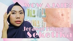 WOW BERKAT SKINCARE JAFRA, JERAWAT HILANG  SEKETIKA!!! - Durasi: 12.07. 