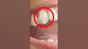 Why These Teeth Are Called Canines 😯