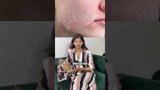 Is Dettol Safe For Your Skin? The Skin House Dr. Sanchika Gupta. Md