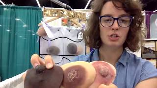 Liquidgoldconcept Breast Health Training Tool Bhtt Clinical Scenarios Part 3