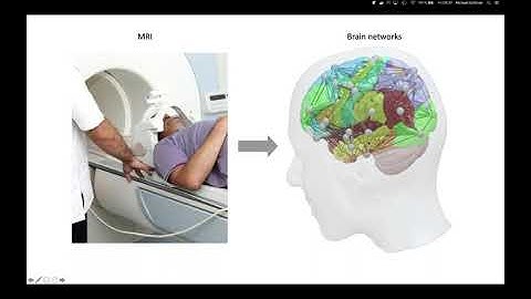 "TVB - EBRAINS integrated workflows: Image Processing Pipeline" - Michael Schirner
