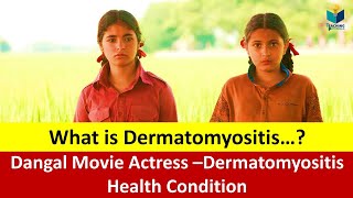 What is Dermatomyositis…? Symptoms, Treatment, Diagnosis, Cure, Prevention.(Disease Condition)