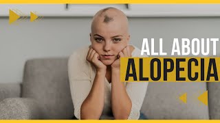 Doctor explains Alopecia Areata (aka patchy or total hair loss) - Signs, Symptoms, Treatment & more