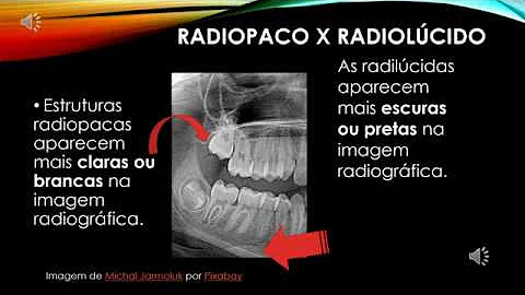 O que é uma imagem Radiopaca?