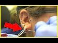 You Have Never Seen An Ear Like This!!