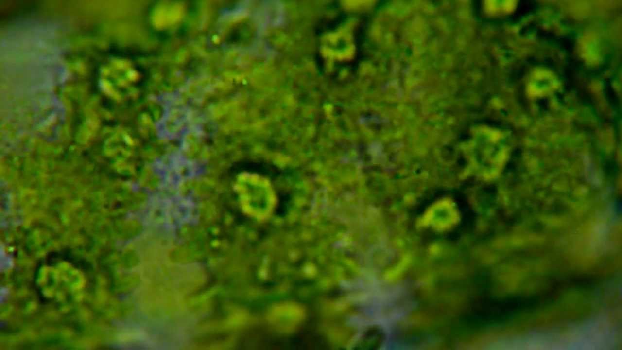 Microbes in Spirogyra YouTube
