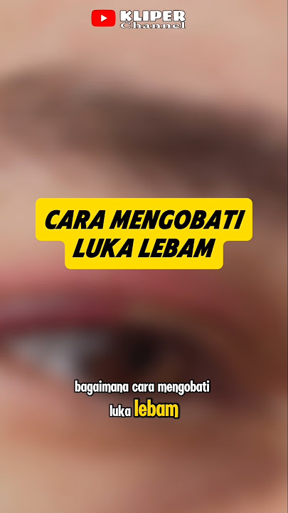 How to Treat Bruises That Are Difficult to Disappear #wounds #bruises #shorts #kliperchannel