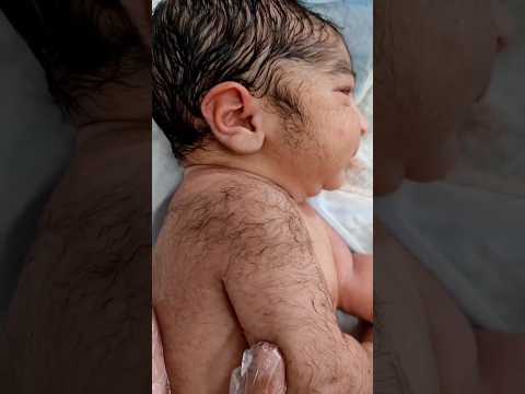 Hairy & Beard from First Day of Life of Cute Newborn baby @AfterBirth