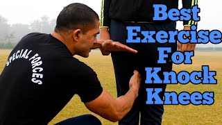 Knock Knees दूर करे With Commando || Commando Fitness Club