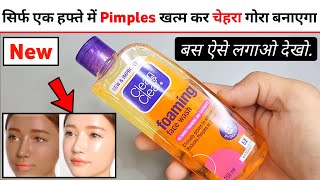 Clean And Clear Face Wash Review | clean clear face wash | clean clear face wash kaise use kare