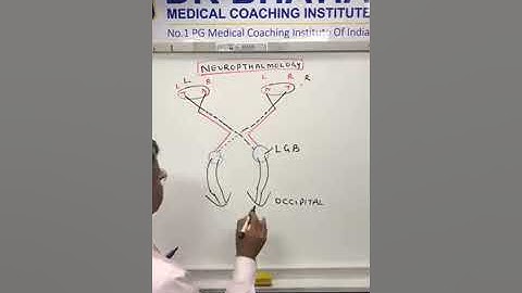 Discussing in Neuro - Ophthalmology