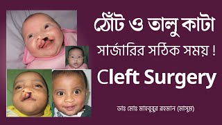 ঠোঁট ও তালু কাটা সার্জারির সঠিক সময় ! Dr. Md. Mahbubur Rahman - Cleft lift Surgery