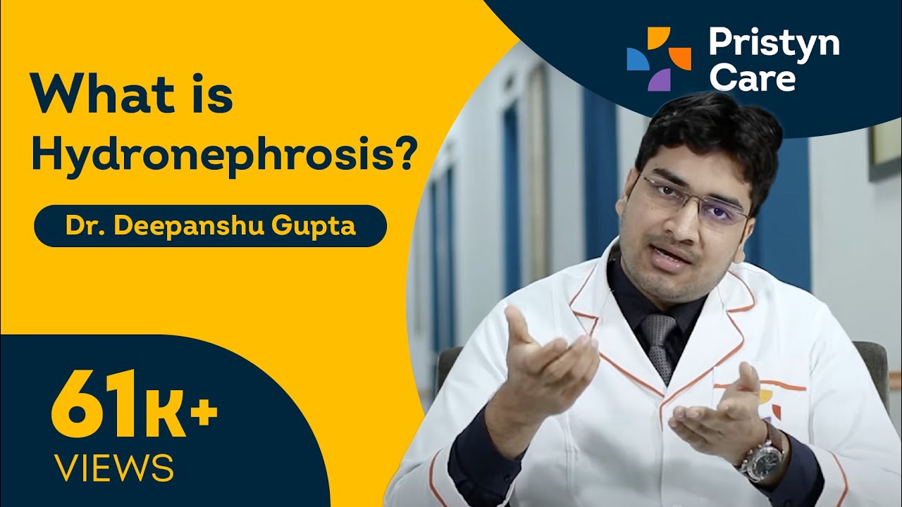 What is Hydronephrosis? | Swelling of Kidney - | Book FREE Appointment 📞9311388971