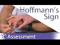 Hoffmann's Sign or Reflex | Upper Motor Neuron Lesion