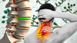 The Body Is Repair After 18 Min.., Alpha Waves Heal The Whole Spine (Warning:Very Powerful!) - 432Hz