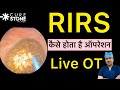 Rirsretrograde intrarenal surgery live ot  laser kidney stone treatment  dr  deepanshu gupta