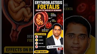 Erythroblastosis Foetalis Explained in Telugu | Rh Incompatibility | NEET Biology
