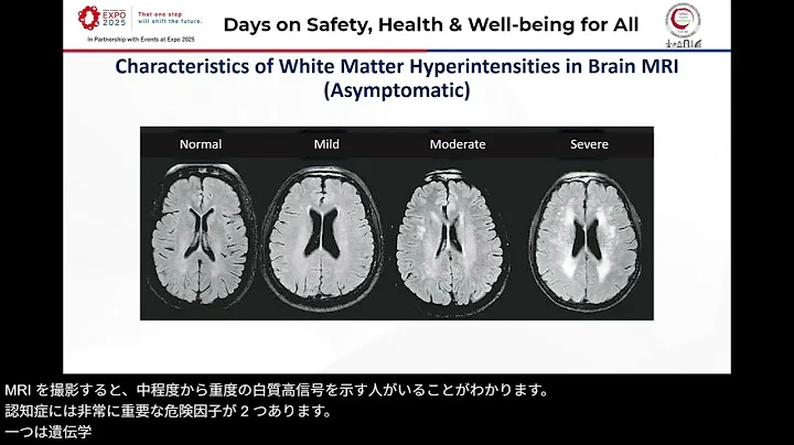 Digital, AI & Tech for Workplace Health & Well-being | GISHW Symposium 2025