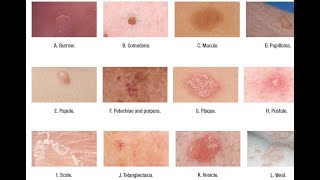 Skin Lesions with defination