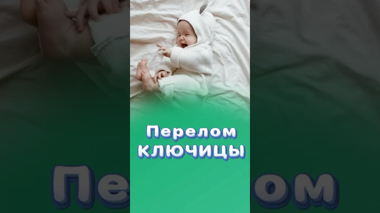 Перелом ключицы у новорожденных! #перелом #центрздоровья #титовцентр