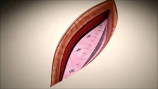 Cicat Open Sublay Animation