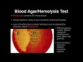 Microbiology: Hemolysis/Blood Agar