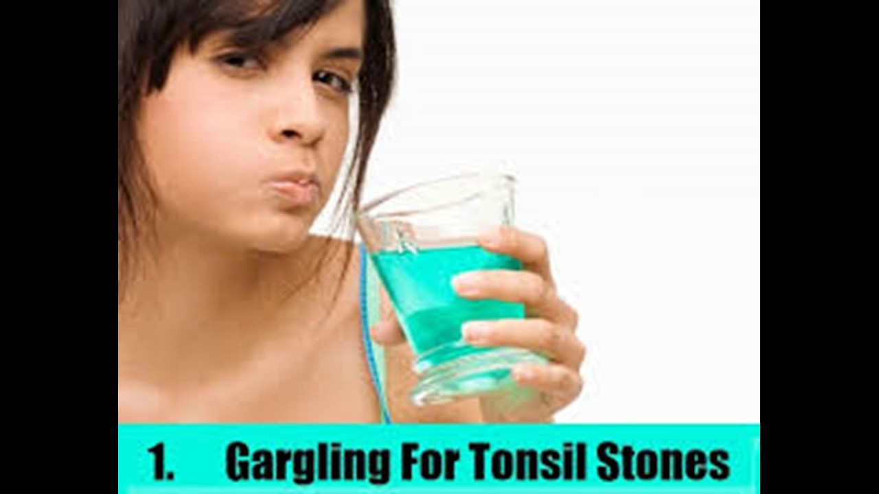 How to remove tonsil stones tonsiliths youtube