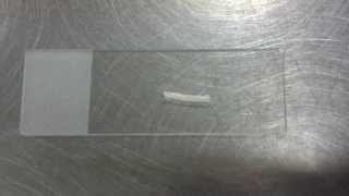 Tapeworm - dipylidium caninum in cat