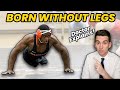 Born WITHOUT LEGS! Doctor Explains INSPIRING Story of Zion Clark