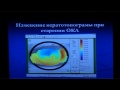 Осложнения после ортокератологических линз