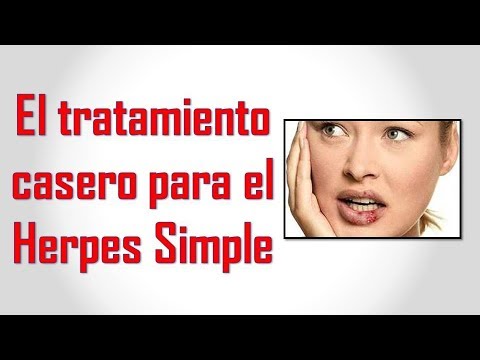Remedios Caseros Para El Herpes En La Piel Tratamiento Casero Para