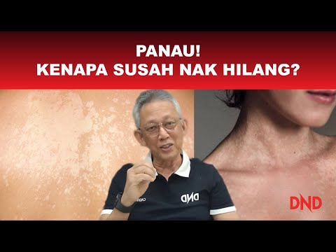 Video: 3 Cara Merancang Pesta Ulang Tahun yang Mengejutkan