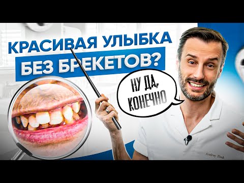 Видео: Как выпрямить зубы без брекетов (с иллюстрациями)