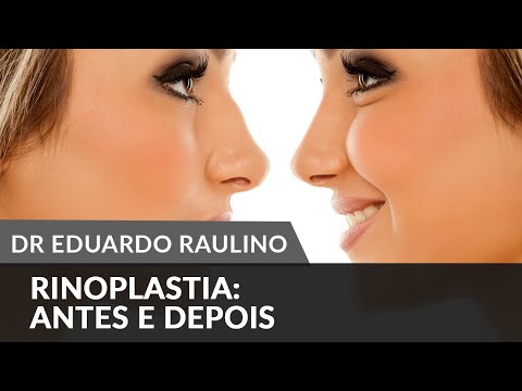 Operação em thickenings do membro
