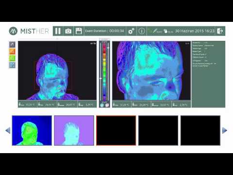 Misther Thermal Camera Application - Free Mode Demo