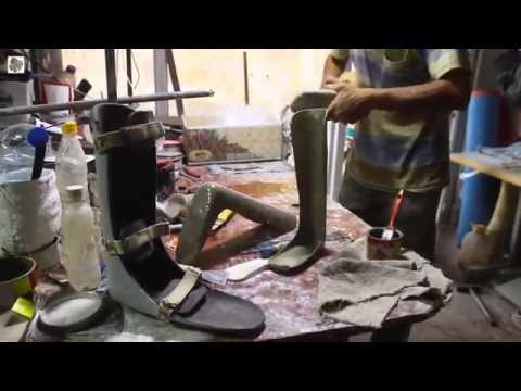 ورشة لتصنيع الأطراف الصناعية في ريف حمص - الجبائر والأجهزة الاستنادية