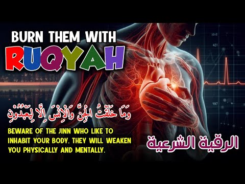 Kill Jinn And Devils Black Magic Which Resides In The Body With Ruqyah Alaa Aqel