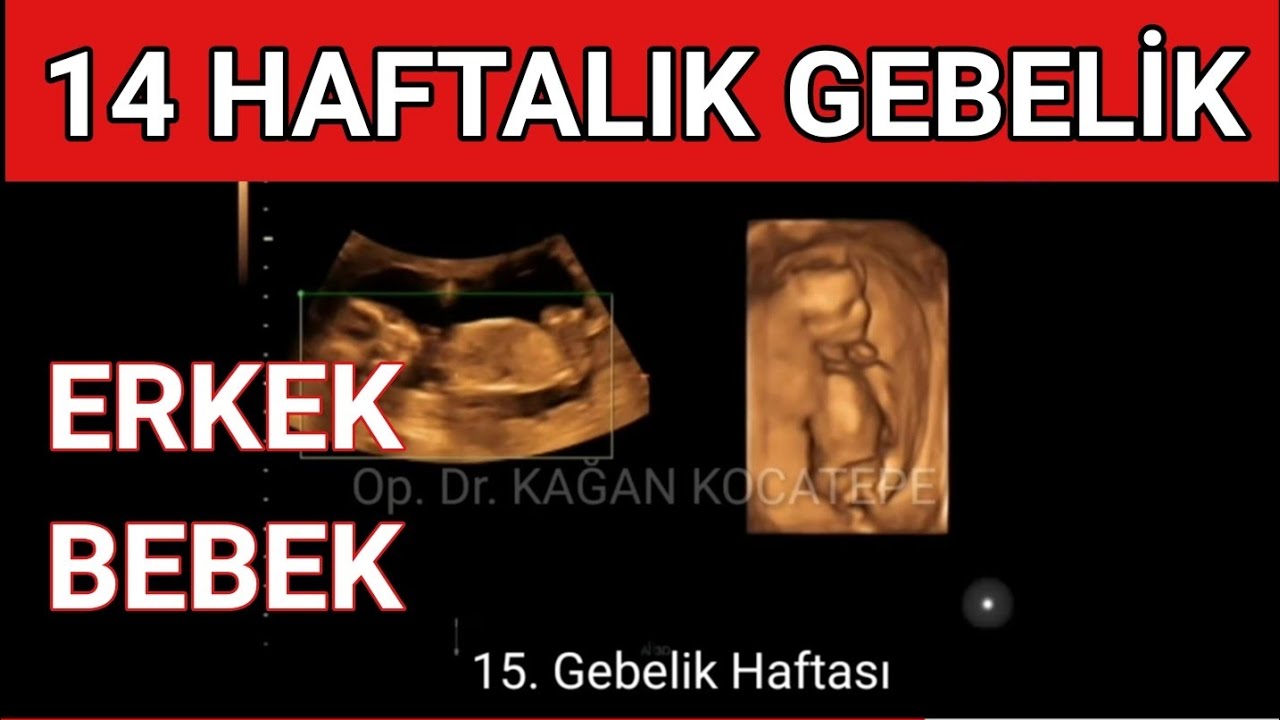 14 haftalik erkek bebek ultrasonda nasil gorunur dogum kanalina yakin yerlesmis plasenta previa youtube