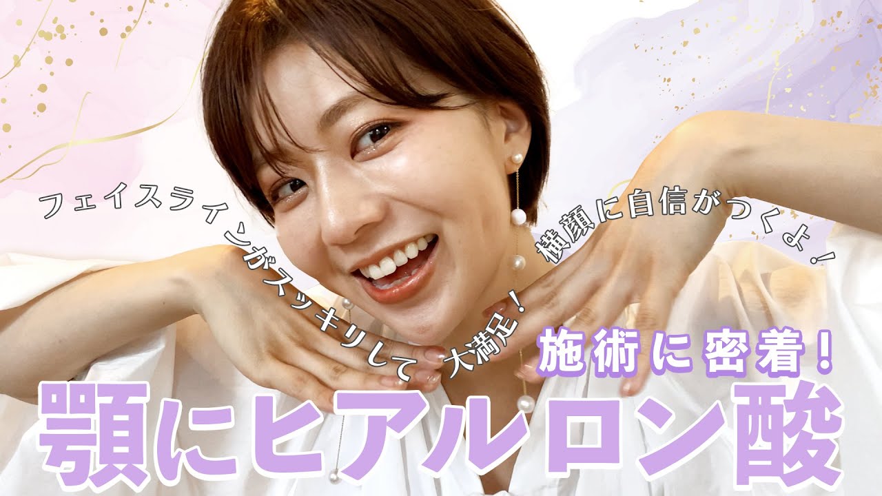 【小顔に見せたい方必見】顎のヒアルロン酸を体験。理想のEラインへの道