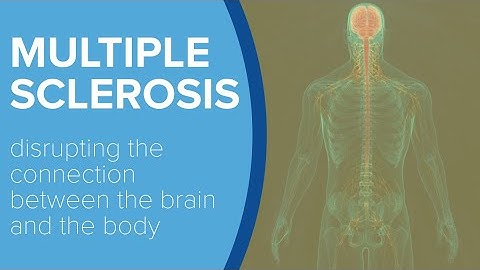 Multiple Sclerosis - Yale Medicine Explains