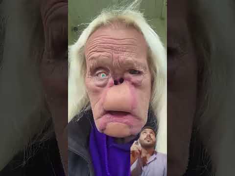 هذا الشخص معاق ويجب عليه أن يعيش أيض ا