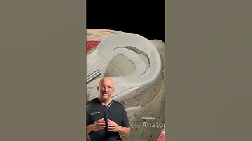 Knee Locked Up? Bucket Handle Meniscus Tear Explained #surgery