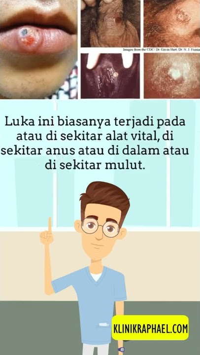 Apa itu Sipilis? Gejala, Penyebab dan Akibatnya - Klinik Raphael #edukasi #penyakitkelamin