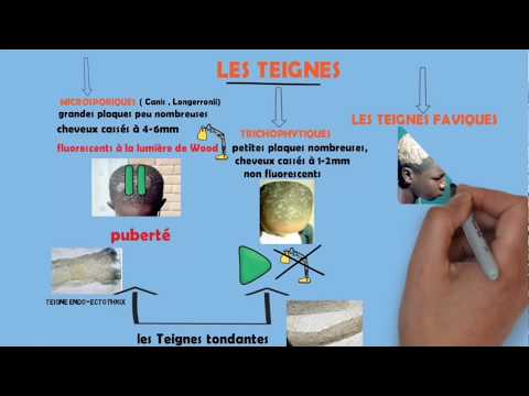 Vidéo: Différence Entre île Et Péninsule