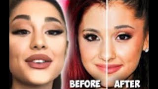 Ariana Grande finally showed her nose after surgery a month the truth about her plastic surgery..!