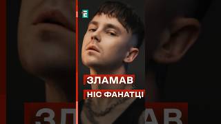 💥 Пивоваров під час концерту зламав ніс фанатці #еспресо #новини
